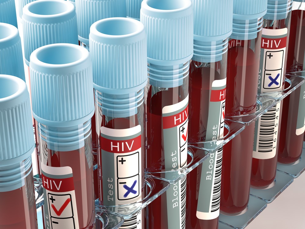 2 men found with a completely drug-resistant form of HIV. Doctors are worried.