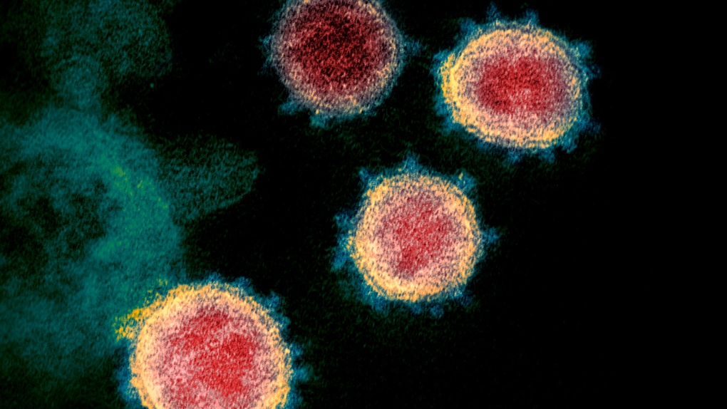 Coronavirus detected in the semen of COVID-19 patients