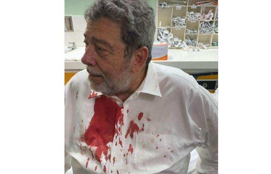 Anti-vaxxers’ attempted assassination of Prime Minister Ralph Gonsalves — Buried Caribbean democratic innocence with a ‘brick’?