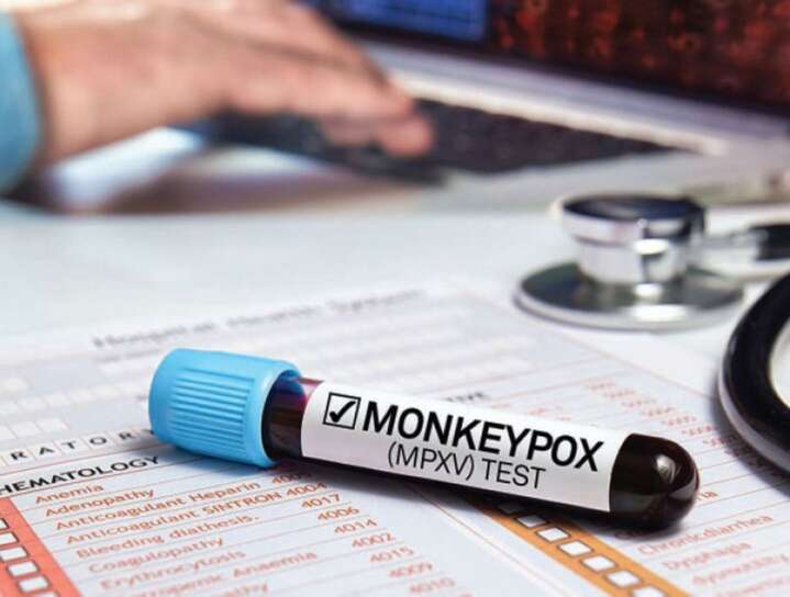 Monkeypox cases top 70,000, says WHO