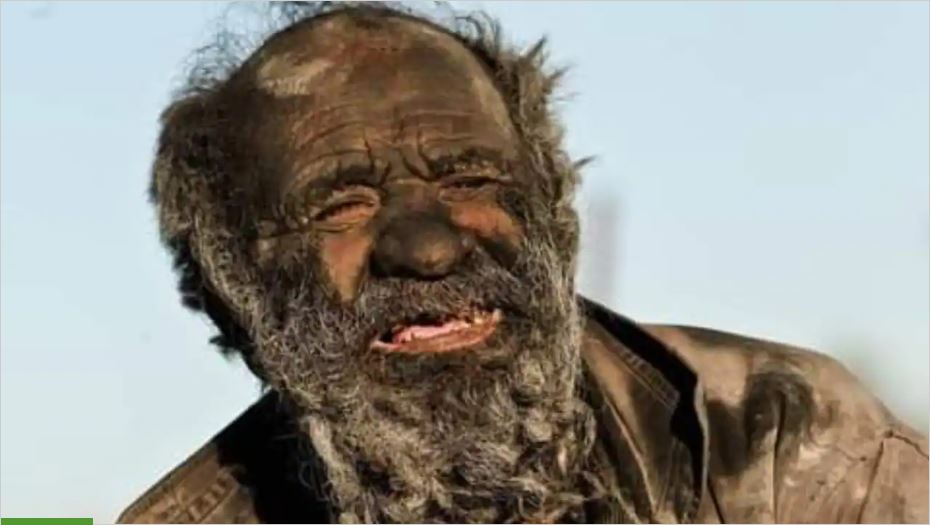‘World’s dirtiest man’ dies at 94, months after his first wash in decades