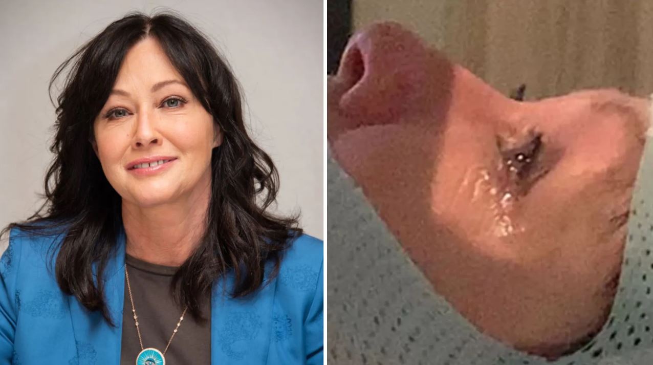 Shannen Doherty says breast cancer has spread to her brain: ‘My fear is obvious’